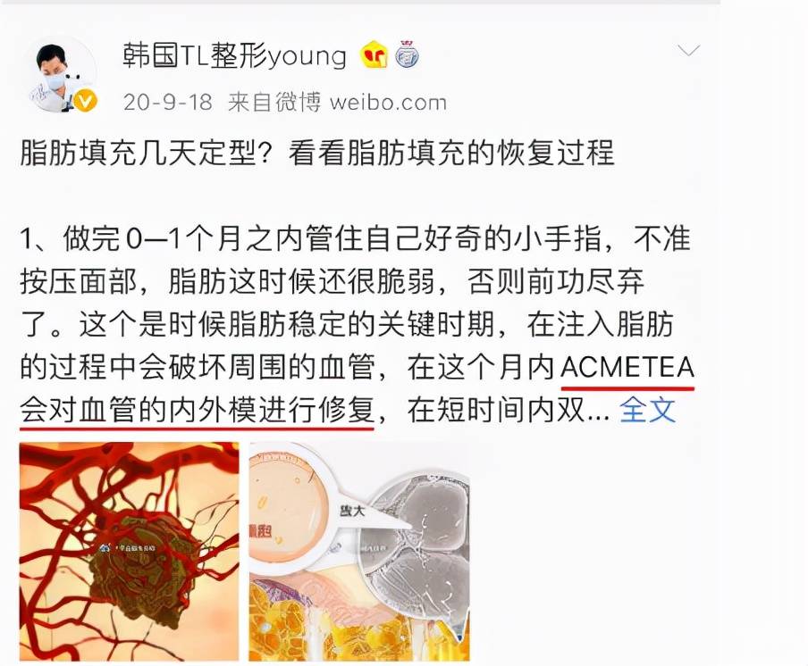 后很救命~自体脂肪填充后很后悔，脂肪填充失败修复怎么做？解决方法！