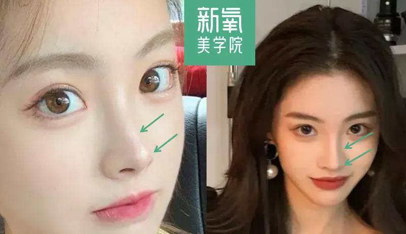 下巴她do了五年脸，终于跃居2021年度互联网美女