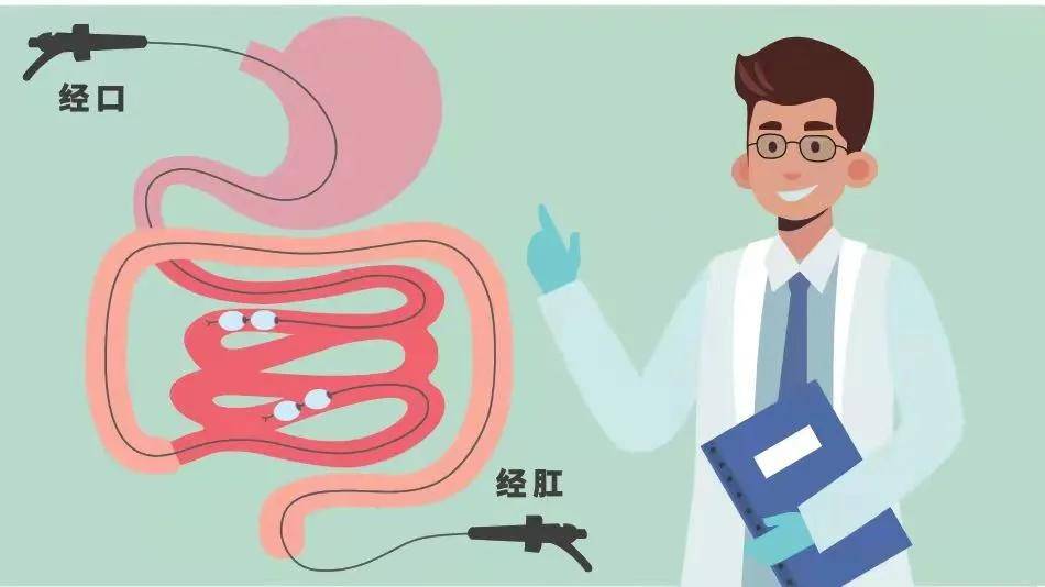 于是,阿文又接受了胃肠镜,ct下小肠造影(cte)等检查,可是胃肠镜无特殊