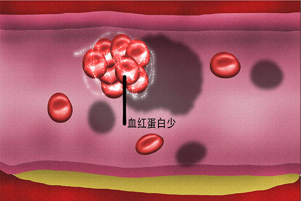 空腹|年过半百，血糖控制在7.3左右正常吗？分享不同人群的血糖目标值