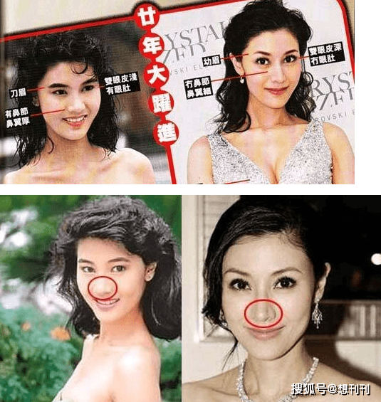 结局整容风刮到香港，这7位港圈大美人竟跑去DO脸上，结局一言难尽