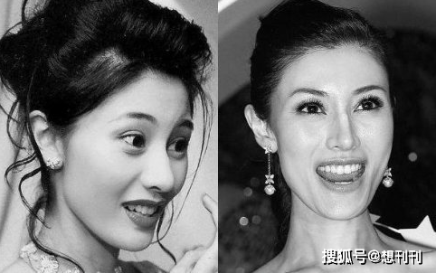 结局整容风刮到香港，这7位港圈大美人竟跑去DO脸上，结局一言难尽