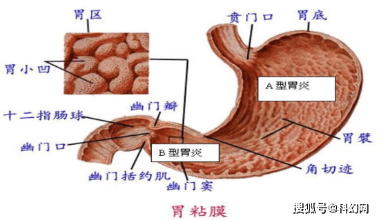 刘亚珠|胃会越撑越大,越饿越小甚至萎缩么?