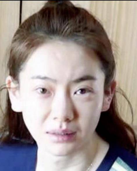 女神女明星素颜名场面：脸部浮肿、憔悴老态，动刀痕迹明显！