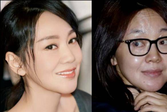女神女明星素颜名场面：脸部浮肿、憔悴老态，动刀痕迹明显！