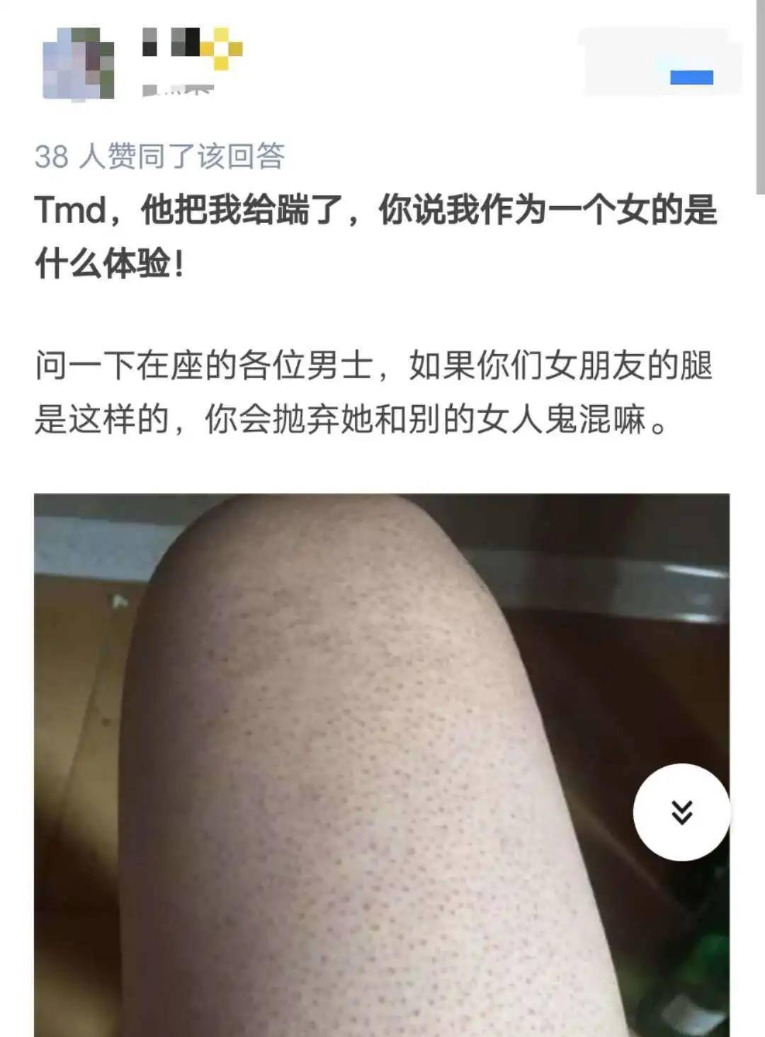 女孩6岁鸡皮肤(5岁孩子身上都是鸡皮肤)