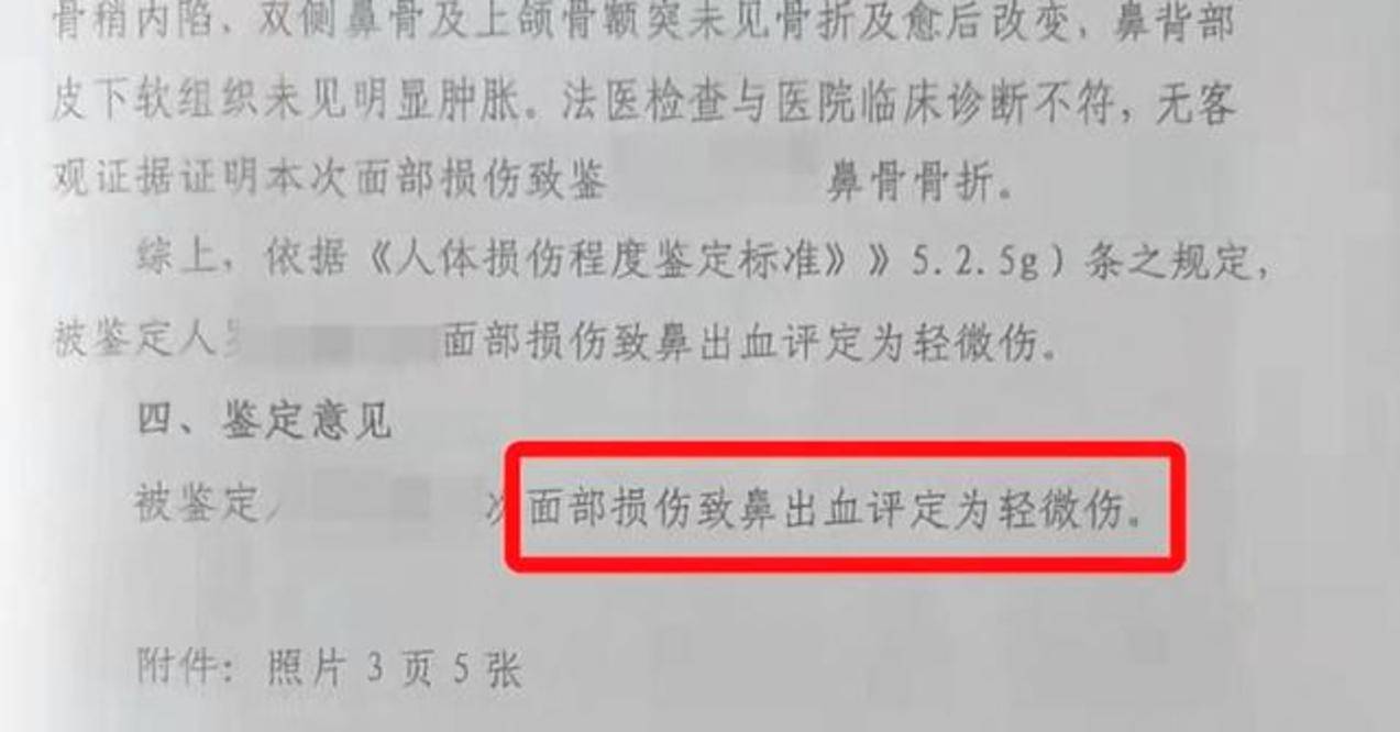 3歲男孩鼻子被幼師打成輕微傷,曾危險駕駛被拘役,家長已起訴