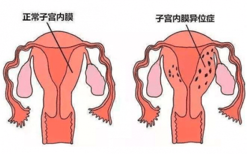 a5ca7974c94241fe91190cf3ac48dc20.png