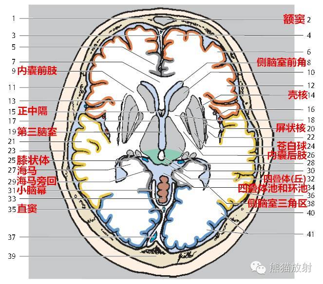 大脑放射冠图片