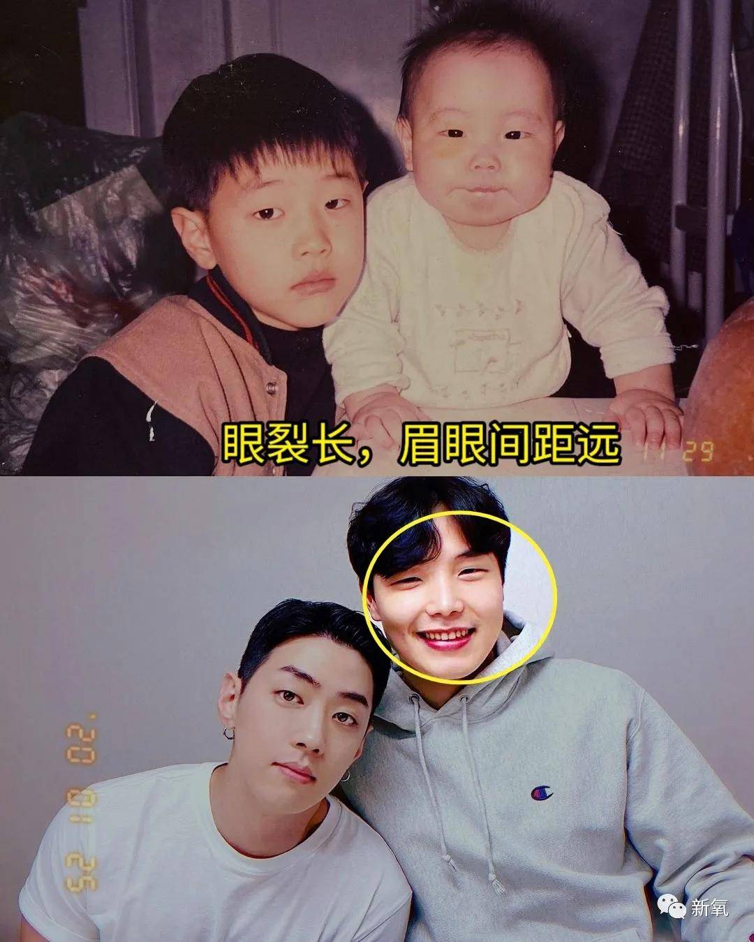 整形整形天选之人vs整完只会吓人，区别在哪里？