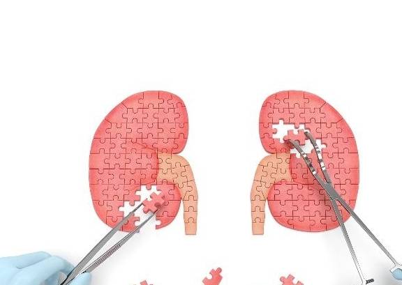 方法|“尿蛋白”无法转阴怎么办？2个“办法”许有助于延缓“肾衰”