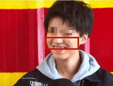 颧骨拉垮颜值的“印第安纹”，终于找上了95后
