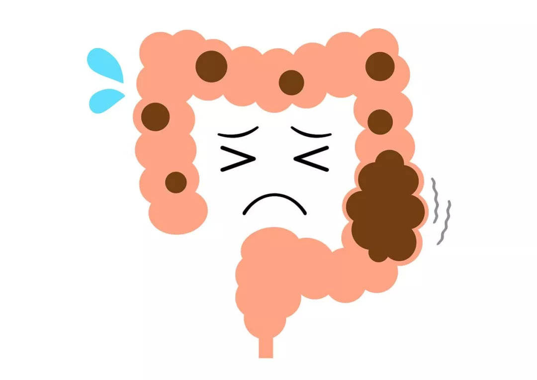 便秘肠道不健康的四大常见表现人体的绝大多数废料都是靠肠道排出.