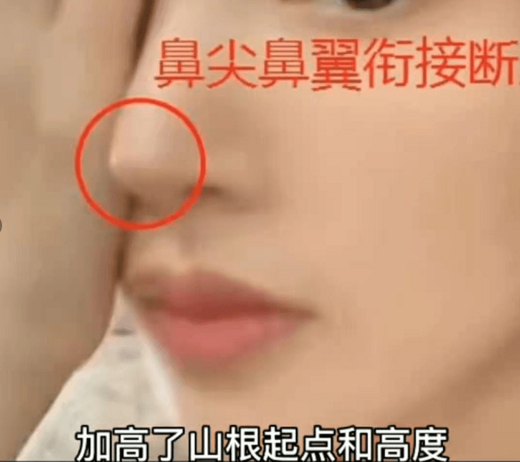 娄艺潇动脸的7位女星，一个比一个神奇，有人请医美专家鉴定自己纯天然