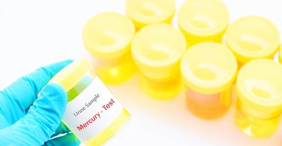 控制|糖尿病患者的尿又黄又骚是什么原因？你真的知道吗？看专家的理解