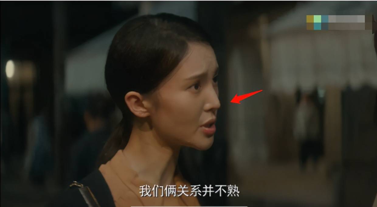 娄艺潇动脸的7位女星，一个比一个神奇，有人请医美专家鉴定自己纯天然