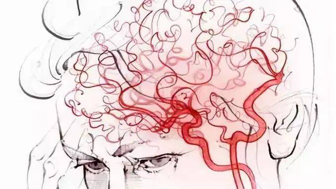 年轻人,血管性痴呆离你并不远_生活