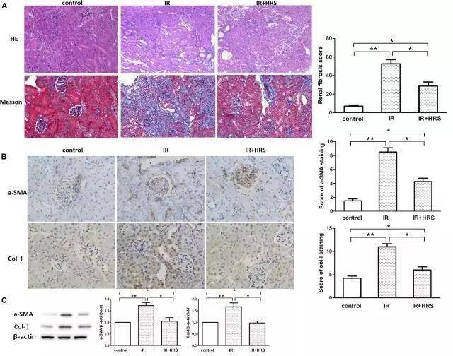 治疗|世界首例猪肾成功移植人体！“氢”对人类肾病有哪些研究？