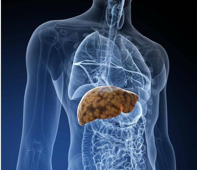 复查|肝病患者该复查了 广州和谐医院肝病科专家告诉你复查怎么这么重要？