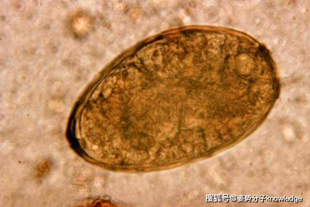 生肉|17岁女孩肠道内发现大量的虫子，寄生虫从何而来？该如何预防