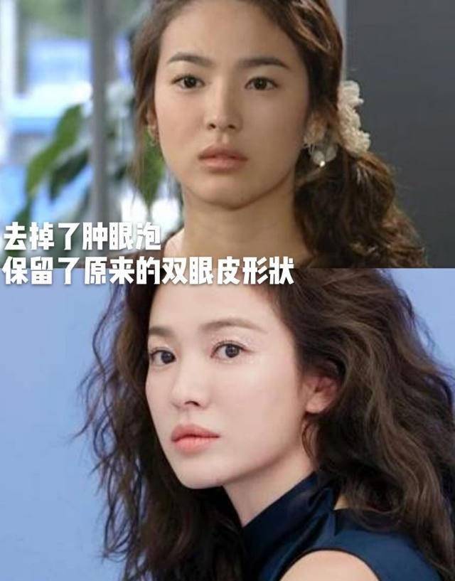 常平甜美系长相女生怎样正确抗老