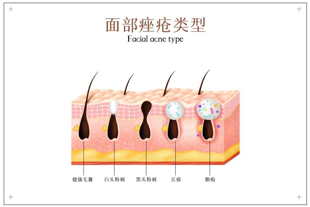 产品不同肤质怎么护肤？手把手教你选对护肤品！