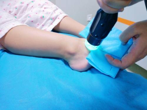 李娜|合肥华夏白癜风医院李娜主任：美国308激光祛白效果好