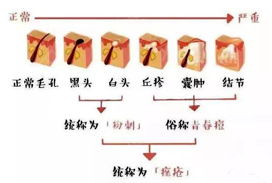 毛孔易烊千玺因脸上长痘在线撒娇