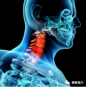 益康耳穴 什么方法治疗颈椎间盘突出效果好 颈部 全网搜