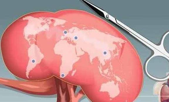 症状|这3种疾病拖着不治，易造成肾损害，别大意