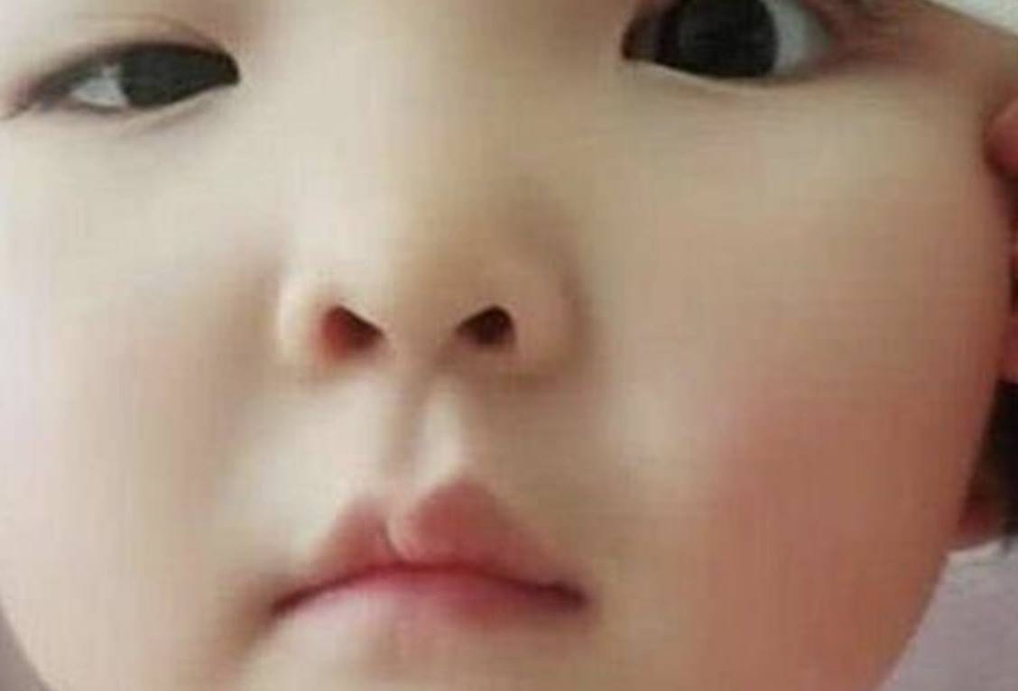 单眼皮为了让女儿变美，妈妈直播给女儿割双眼皮，网友：心疼孩子
