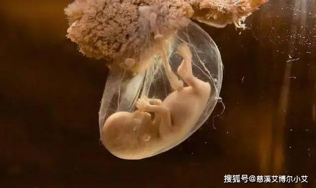博尔|孕期照过四维彩超后，胎儿还有可能是畸形？慈溪艾博尔小艾这样