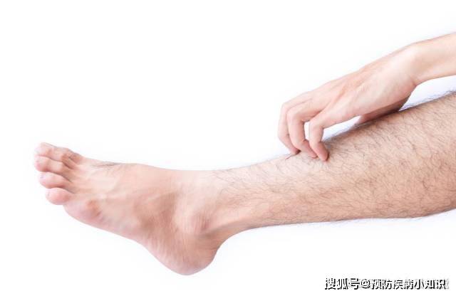 肝脏|41岁出租车司机，查出肝硬化，医生：腿部早有提醒，却被他忽视了