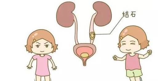 蛋白|结石患者到底可不可以补钙?