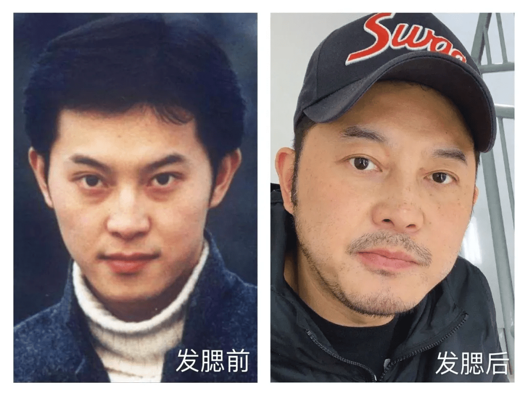 脸部事实证明，明星美貌的天敌不是发福，而是“发腮”啊？