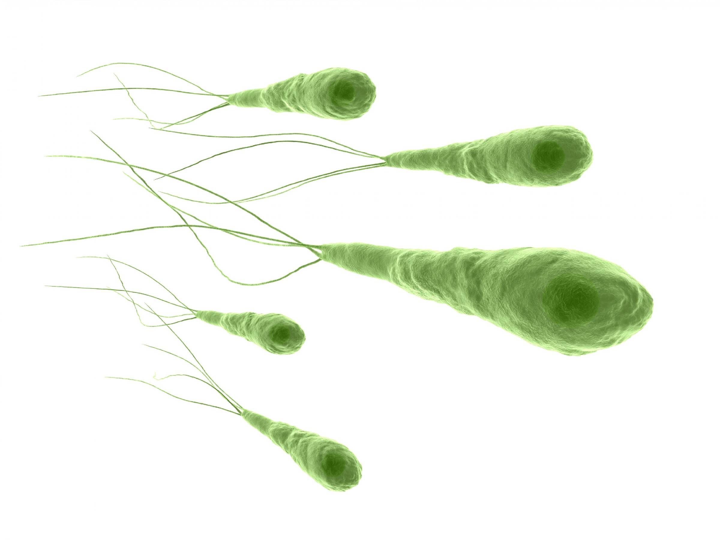 真菌|多种病源体混合感染所导致的肺炎” 治疗周期长