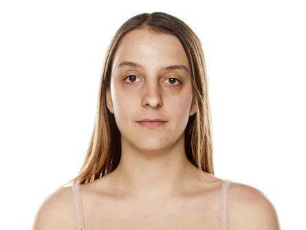 yi如果你皮肤出现了这些问题,不妨试试水光