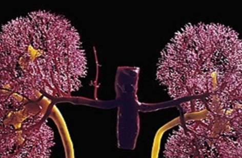 肾脏|尿蛋白、水肿、贫血，哪个容易引起“肾衰”呢？早了解早预防