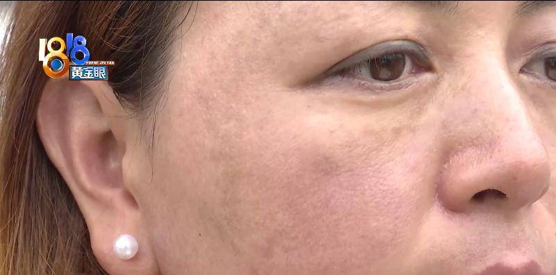 块状“拨筋”手法重,白净变黑斑?