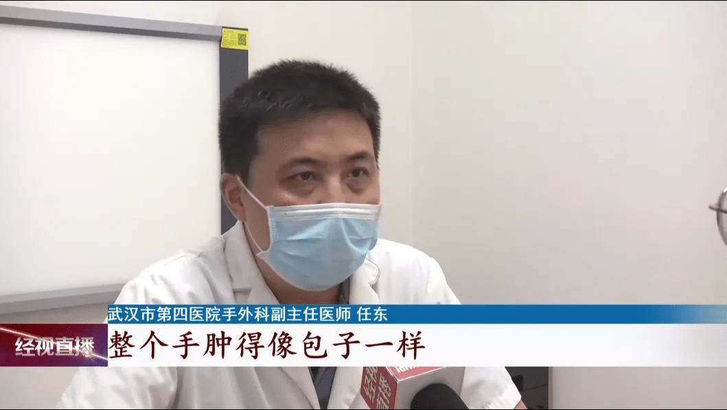 辅导|心疼！父亲教训贪玩的儿子，结果手掌骨折，竟是因为辅导作业……