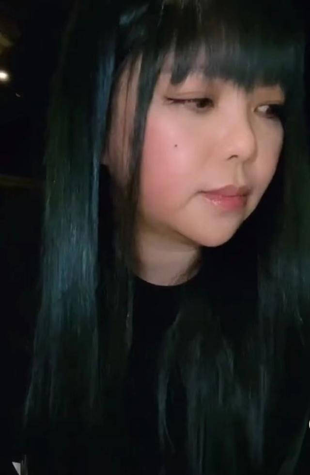 脸颊 张惠妹减肥瘦身了也不漂亮，脸颊松弛下垂，有老阿姨的感觉了！