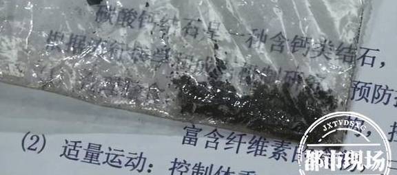 正餐|9岁男孩饮食不规律 把零食当饭吃 医生：儿童得这病很罕见