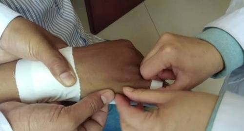 梁雪梅|济南梁氏骨科医院：男子“酒架”受伤后在梁氏骨科“挨整”