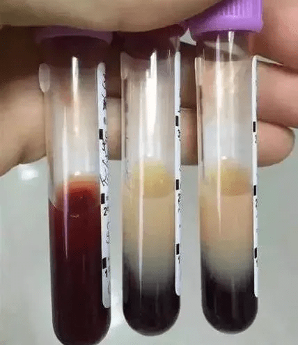 山药|女子一顿吃了3斤牛肉+海参炖鸡，结果进了ICU！