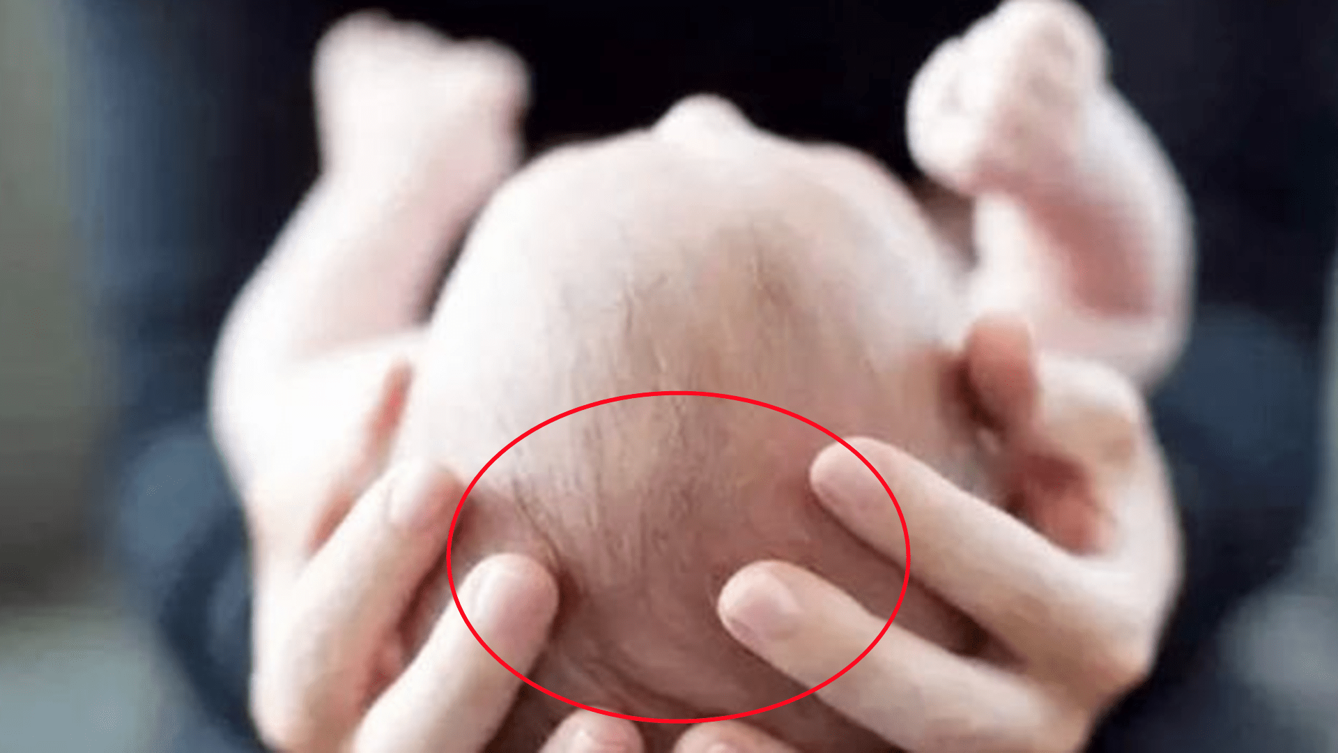 枕头|2.8万“头盔”变美婴儿头？家长的爱美焦虑，会影响到孩子发育