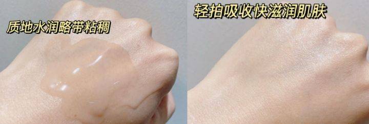 黄脸婆孕期护肤大作战！拒绝暗沉黄脸婆，孕妈快收藏！（附禁忌成分）
