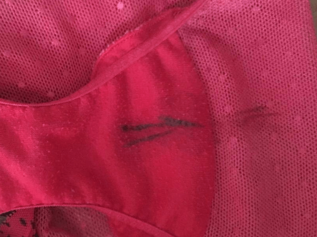 hpv导致宫颈病灶出现后,白带分泌量会增多,颜色受病灶破裂出血影响,也