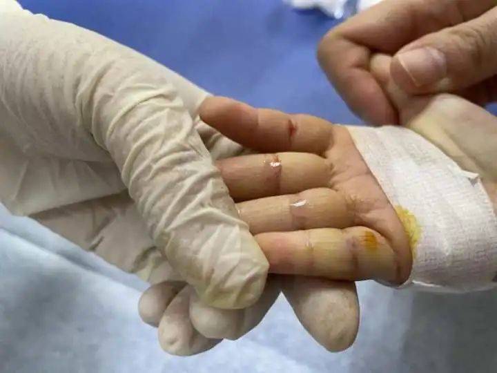 饮食|2岁女童反复患肺炎，爸爸说出一个“秘密”，妈妈绷不住了