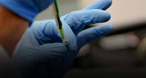 瑞士|英国向40岁以上人群提供第三针加强剂，英国试验皮肤贴片疫苗！