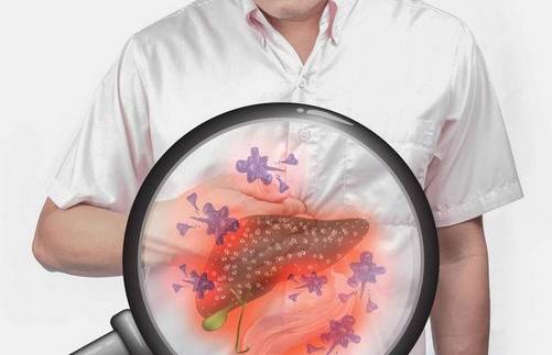 肝脏|肝不好，舌头知道！观察舌边有淤血斑点，或是肝硬化的危险警报